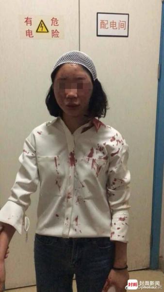 女大学生昆明旅游遭殴打浑身是血 嫌犯曾露奇