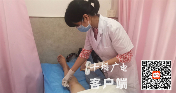 针灸治疗