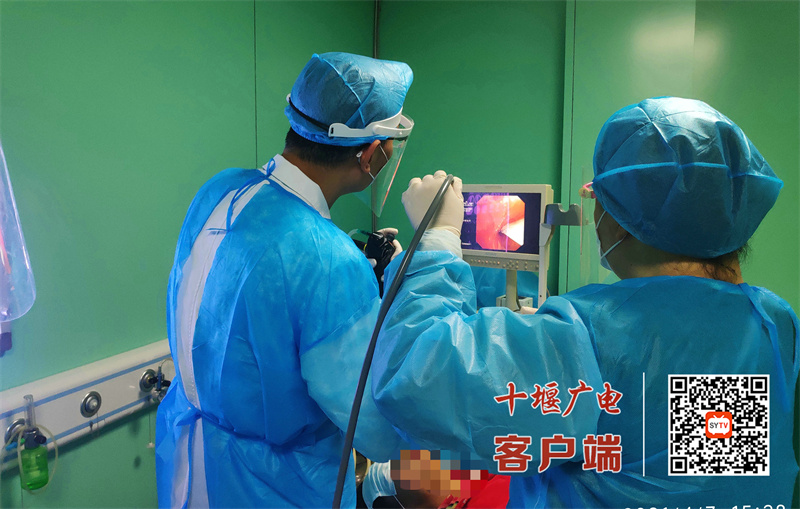 经气管镜冷冻治疗支气管结核