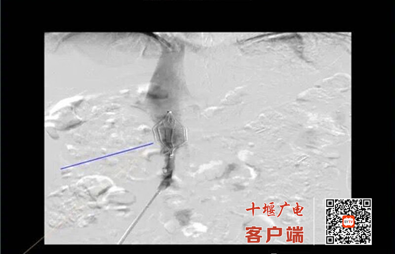 QQ截图20220421113151