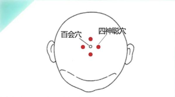 20241116083634655