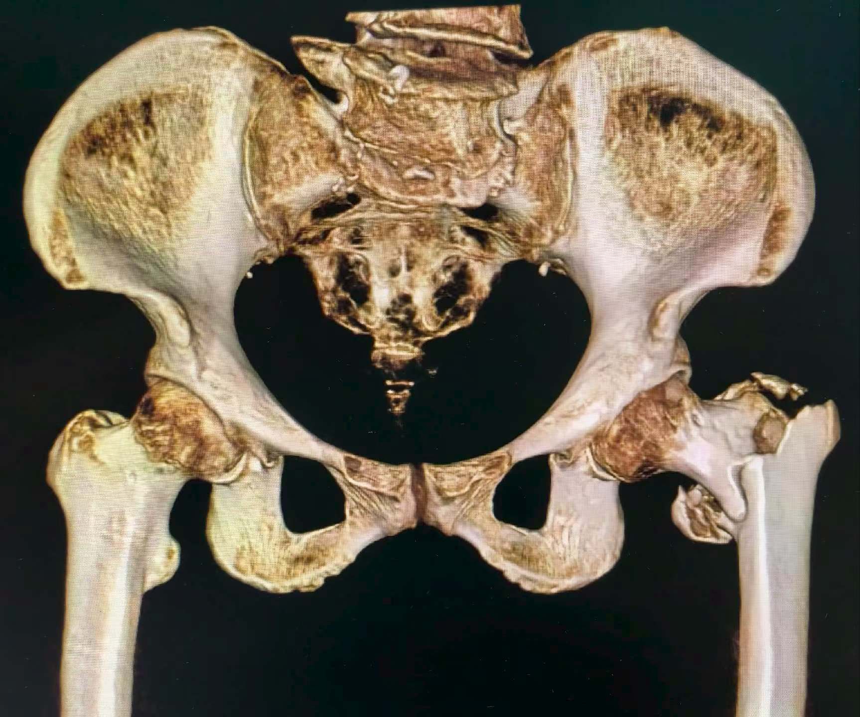 BD31452DDD293AB5B469A4A8AC25184D