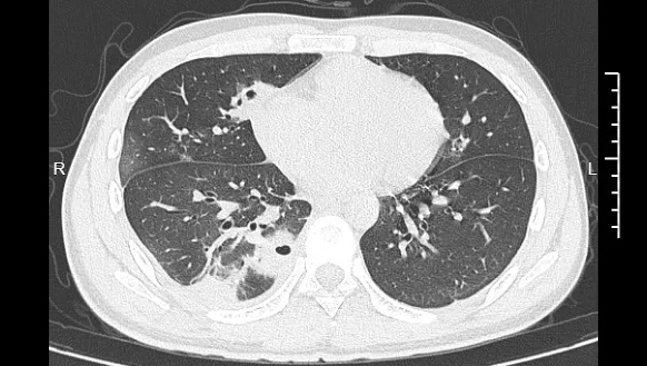 640_wx_fmt=png&from=appmsg&tp=webp&wxfrom=5&wx_lazy=1