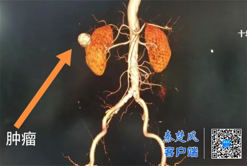 4DC7C5CBDCAAAE82E16725F6D95E9C84