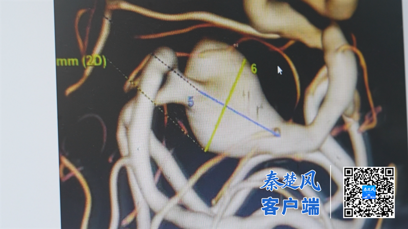 30C17763A57D83E4F7EF0250C739ADA1